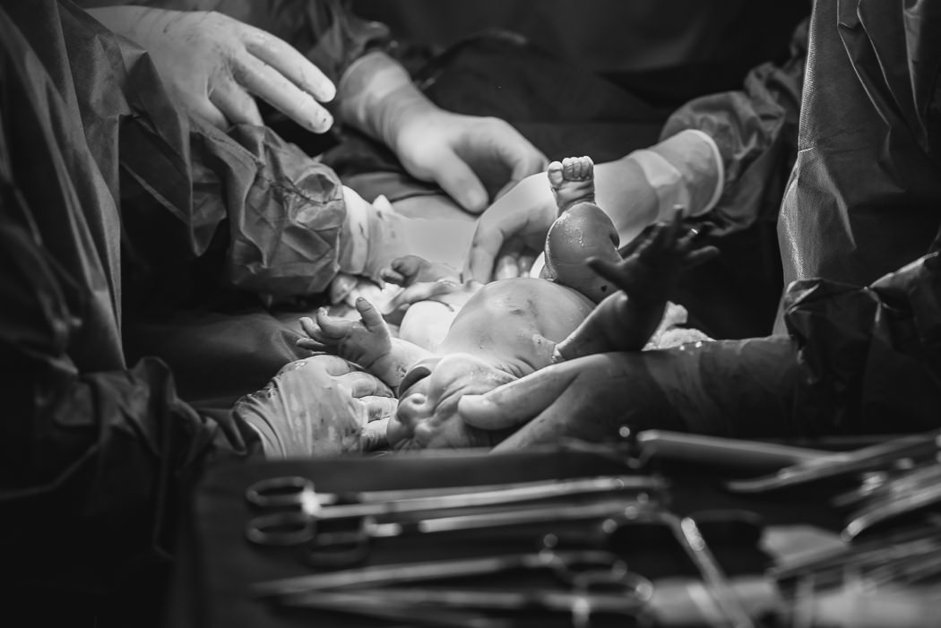 fotografia pb de bebe em parto cesarea - Bruno Montt Fotografia